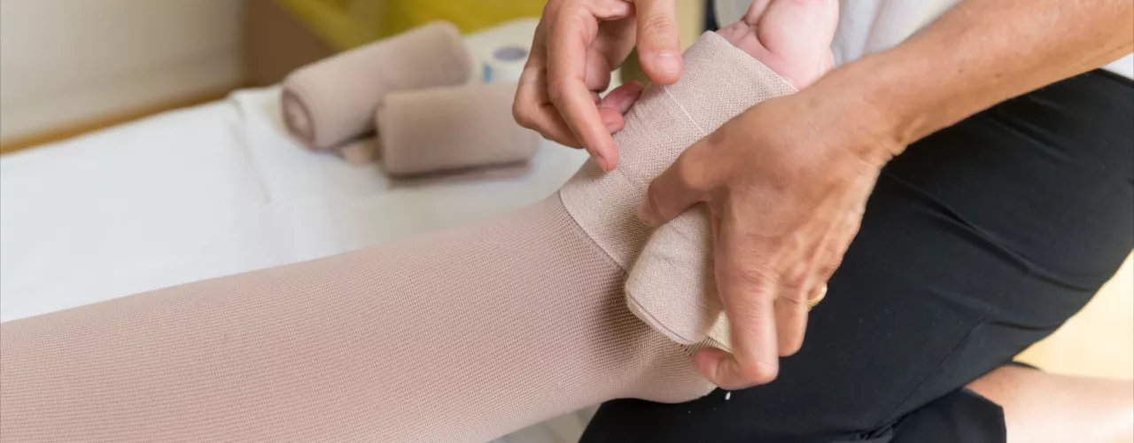 Lymphadema Modesto, CA